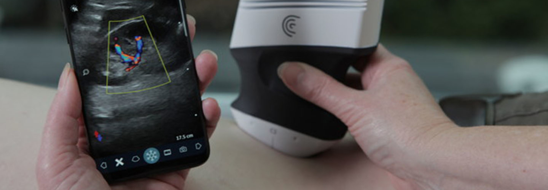 Clarius C3 Wireless Scanner