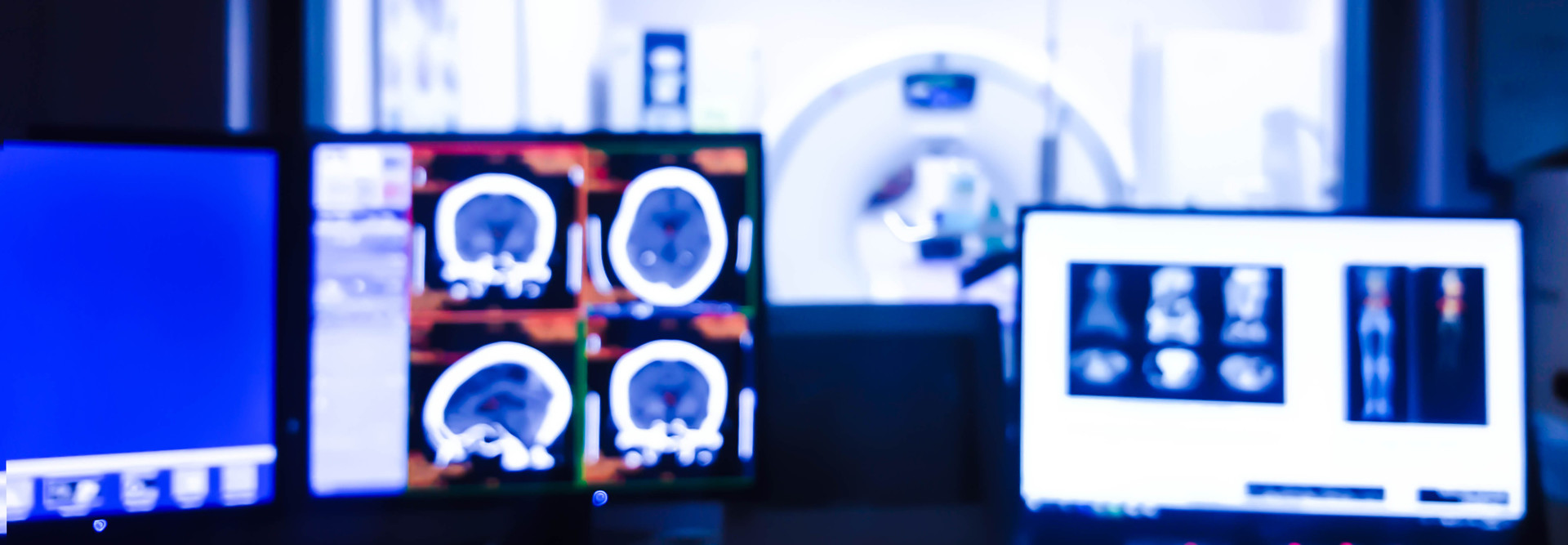 CT scans on screen