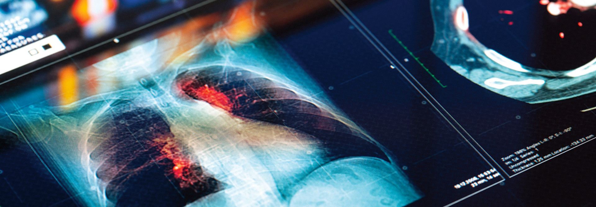 medical display showcase lung MRI