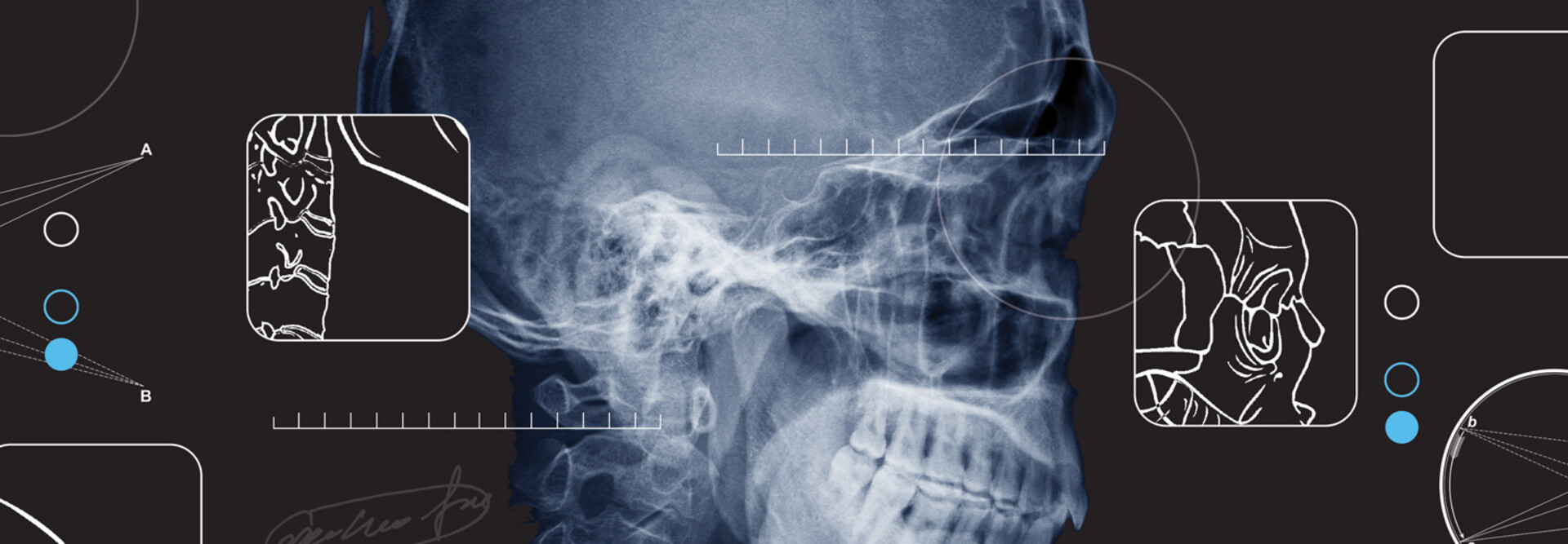 x ray of a skull