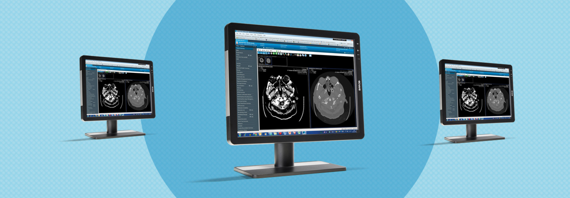 Barco Eonis Monitors are DICOM compatible and an ideal display for medical image viewing.