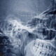 x ray of a skull