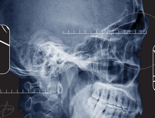 x ray of a skull