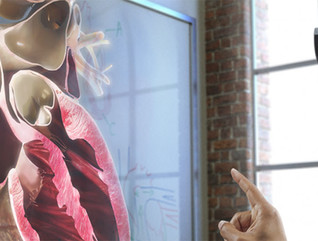 Microsoft HoloLens