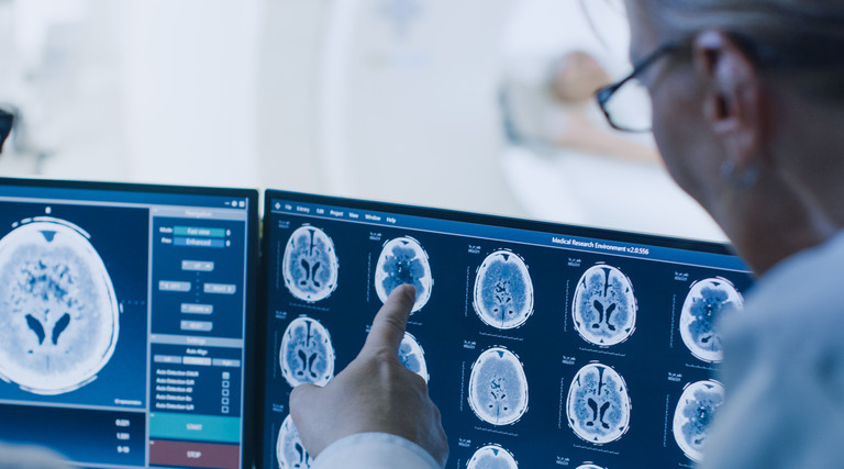Clinicians looking at MRI scans