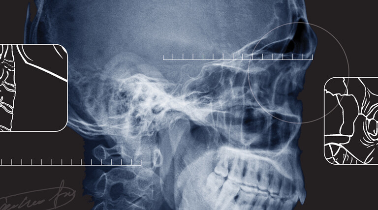 x ray of a skull