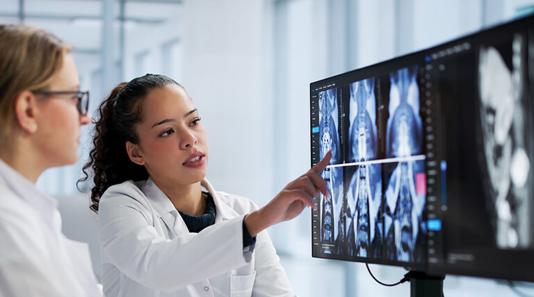 doctors look at brain scan