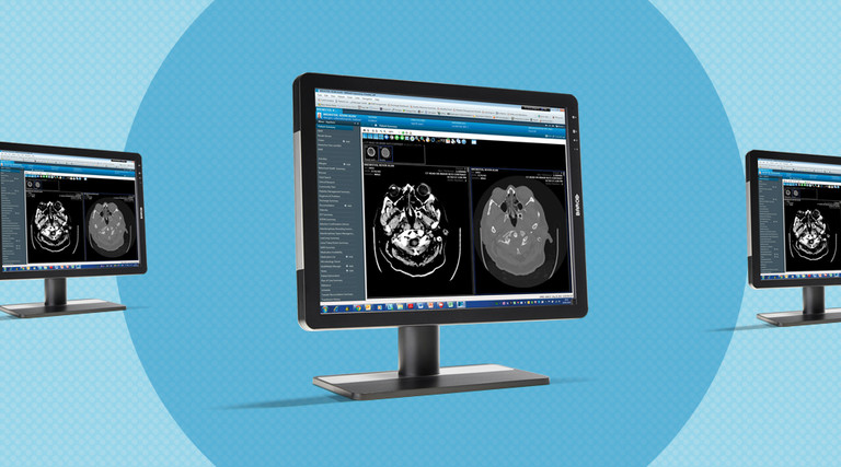 Barco Eonis Monitors are DICOM compatible and an ideal display for medical image viewing.