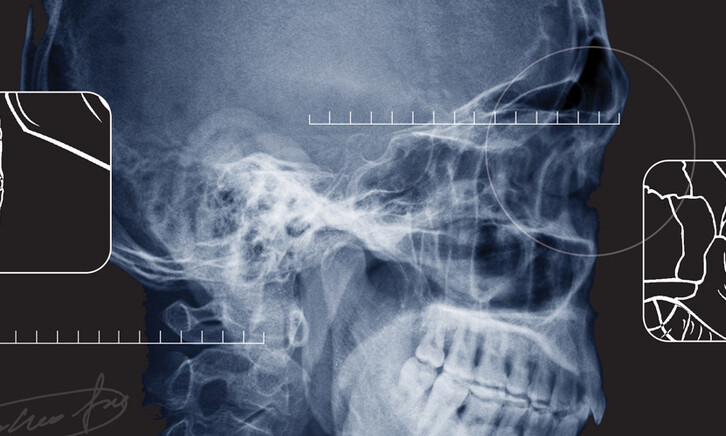 x ray of a skull