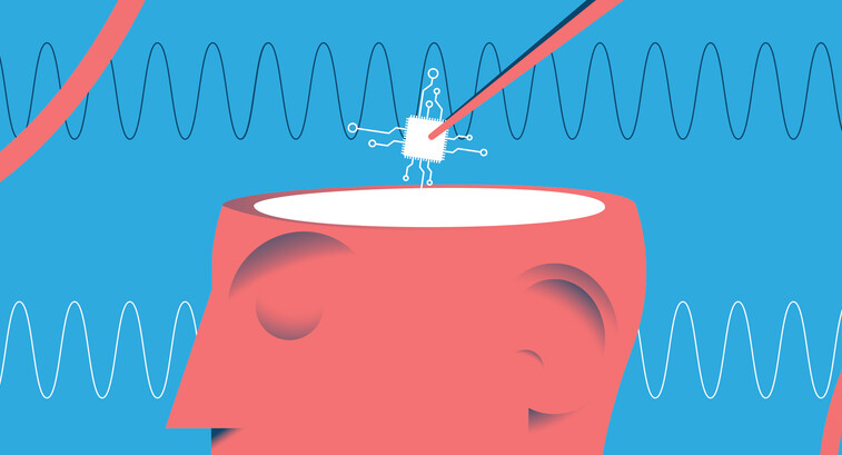 illustration of computer chip being put inside head with waves