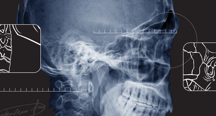 x ray of a skull
