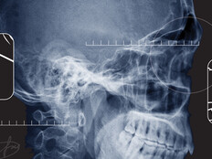 x ray of a skull